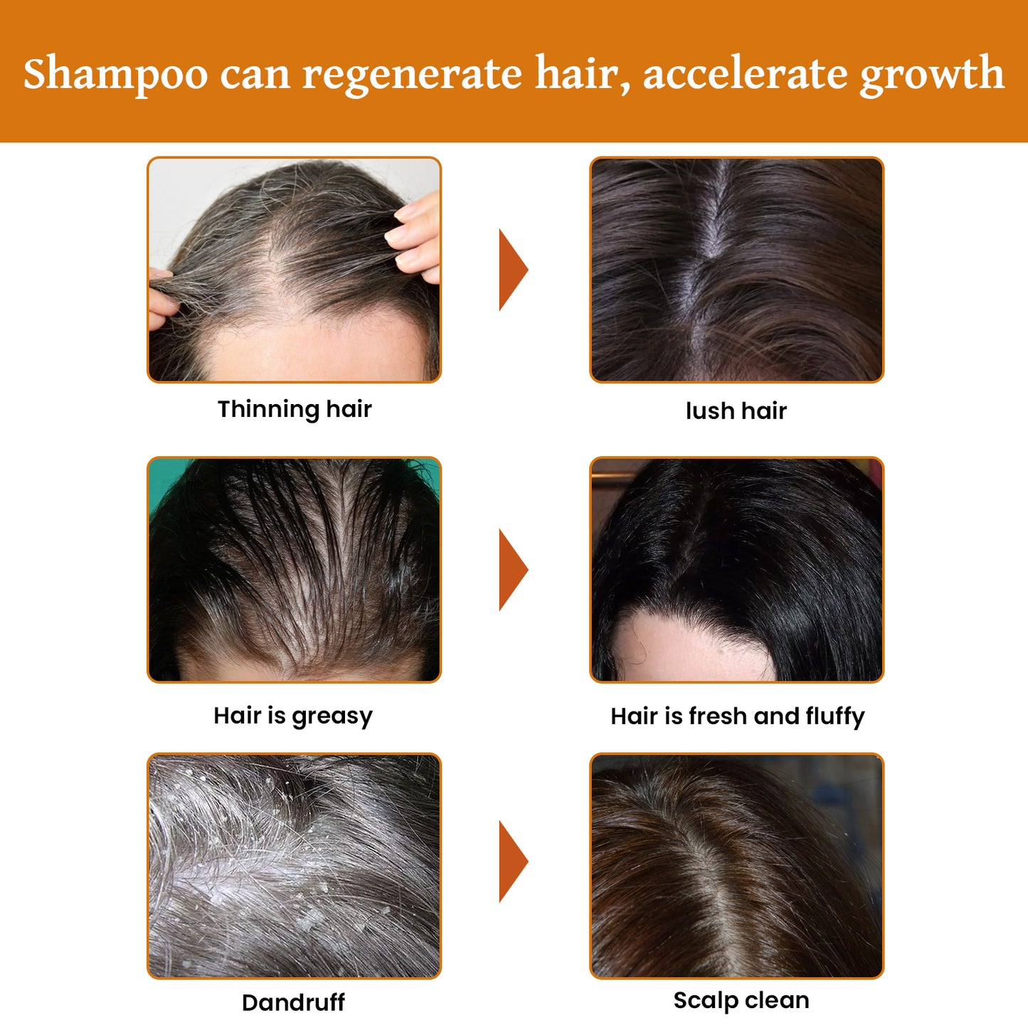 Rice Dense Hair Shampoo Deep Clean Thick Hair Moisturizing Hair Root Solid Hair Care Shampoo Health Eprolo https://www.cyberehub.com