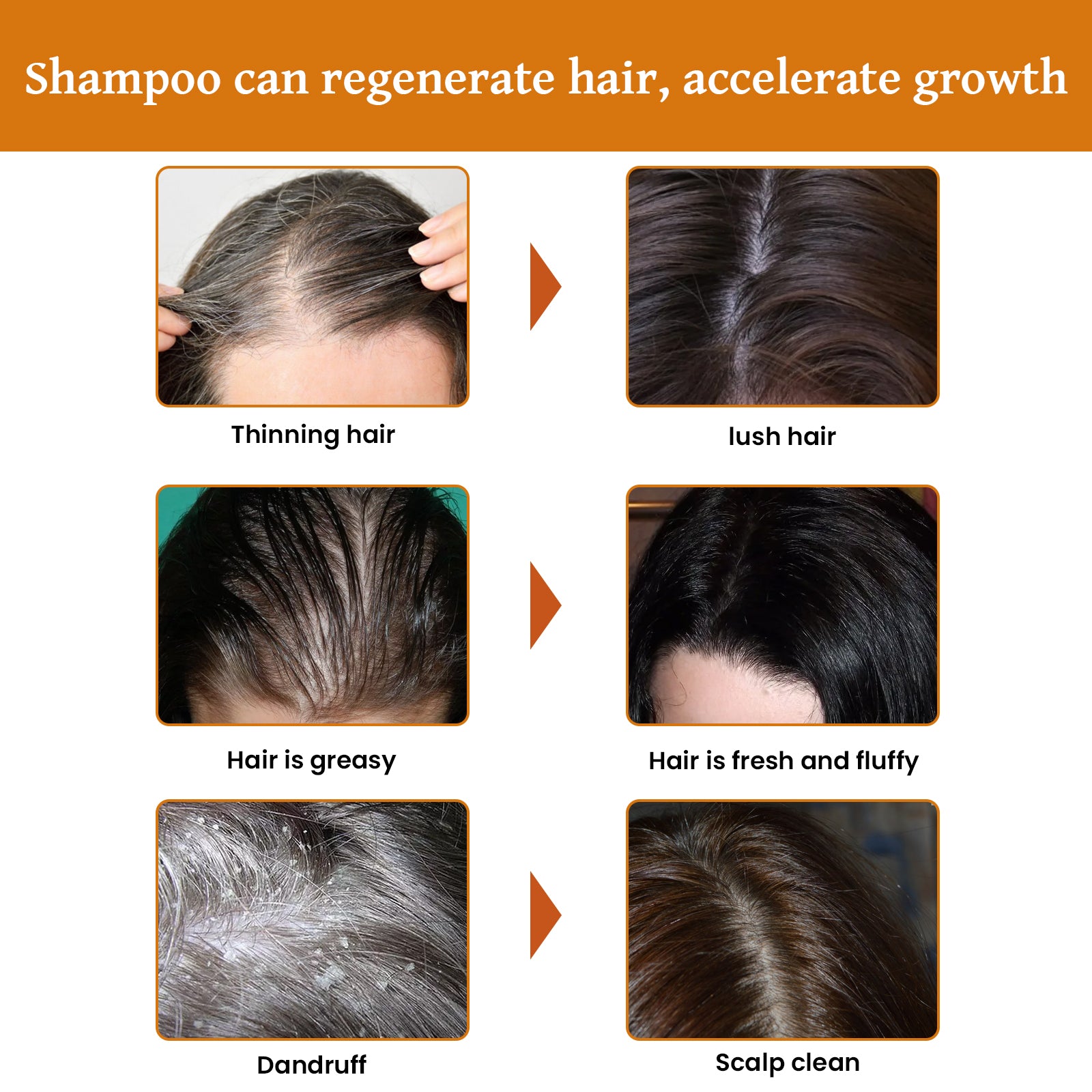 Rice Dense Hair Shampoo Deep Clean Thick Hair Moisturizing Hair Root Solid Hair Care Shampoo Health Eprolo https://www.cyberehub.com