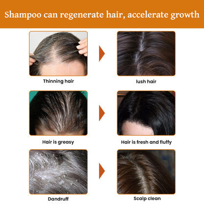 Rice Dense Hair Shampoo Deep Clean Thick Hair Moisturizing Hair Root Solid Hair Care Shampoo Health Eprolo https://www.cyberehub.com