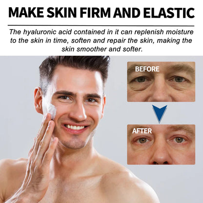 East Moon Men's Anti-wrinkle Cream To Lighten The Fine Lines And Wrinkles Tightening Facial Skin Hydration Anti-aging Cream Health Beauty CJ USa USPS Muqe https://www.cyberehub.com
