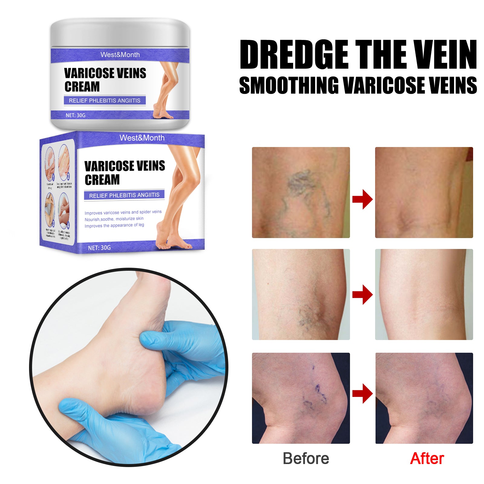Leg Care Cream Gentle Care For Leg Discomfort Daily Moisturizing Maintenance Topical Massage Cream Health Eprolo https://www.cyberehub.com