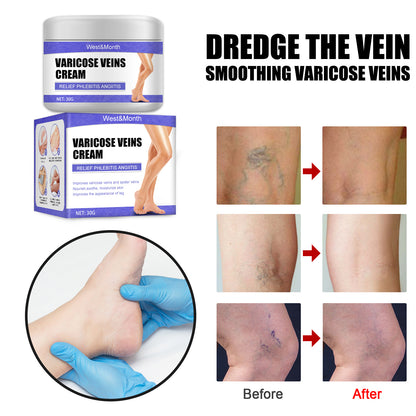 Leg Care Cream Gentle Care For Leg Discomfort Daily Moisturizing Maintenance Topical Massage Cream Health Eprolo https://www.cyberehub.com