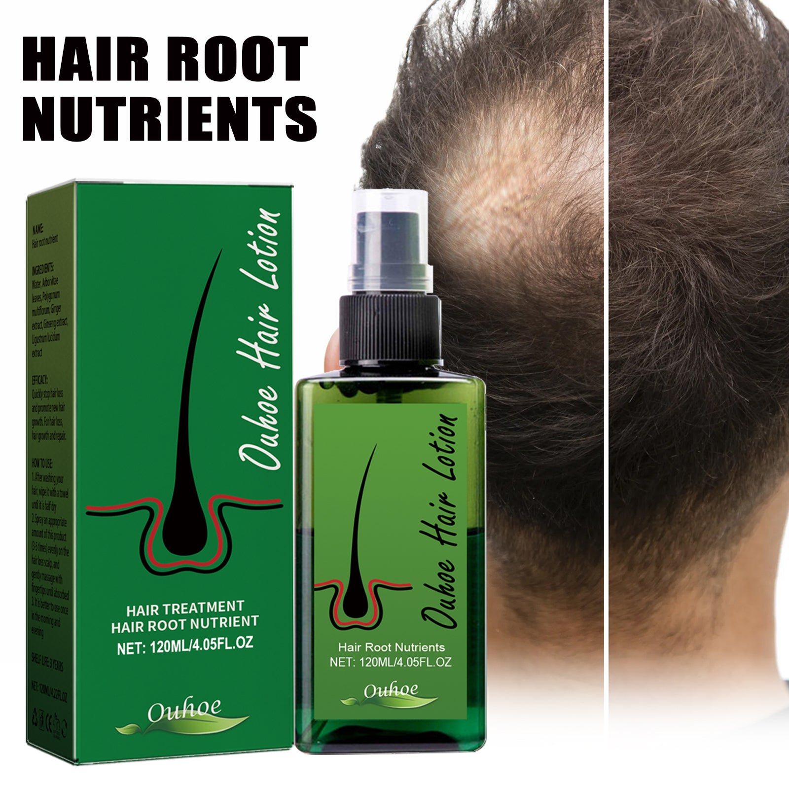 Dense Hair Spray, Anti-Loss Hair Strengthening Hair Repair Hair Root Hair Care Spray Health Eprolo https://www.cyberehub.com