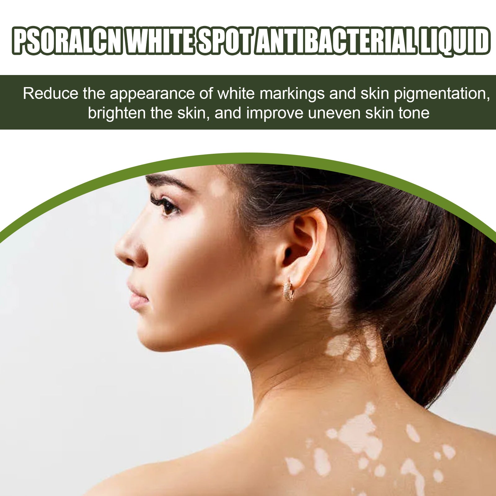 White Spot Purifying Serum For Whitening And Repairing White Spot Spot And Perspiration Spot Skin Moisturizing Serum Health & Beauty Health Eprolo https://www.cyberehub.com