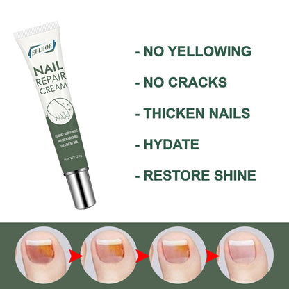 Foot Care And Thickening Nail Repair Cream. Nail Repair Cream Health Eprolo https://www.cyberehub.com