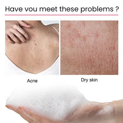 Carbon Clay Back Soap Whitening Body Cleansing Skin Lightening Dark Spots Acne Mark Exfoliating Moisturizing Brightening Soap Health & Beauty Health Eprolo https://www.cyberehub.com