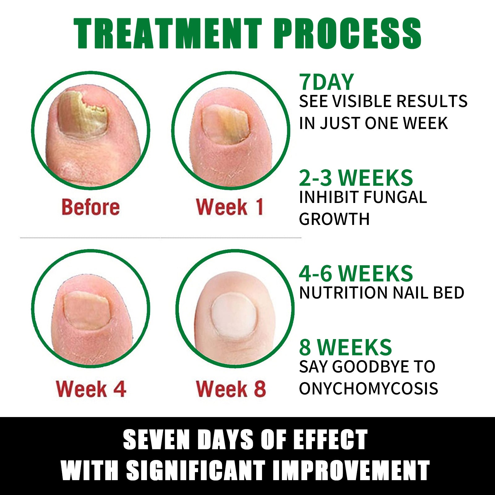 Jaysuing Ginger Nail Care Solution, Repair Hand, Foot And Nail Care Soft Nail Shine Moisturizer Gray Nails Health Eprolo https://www.cyberehub.com