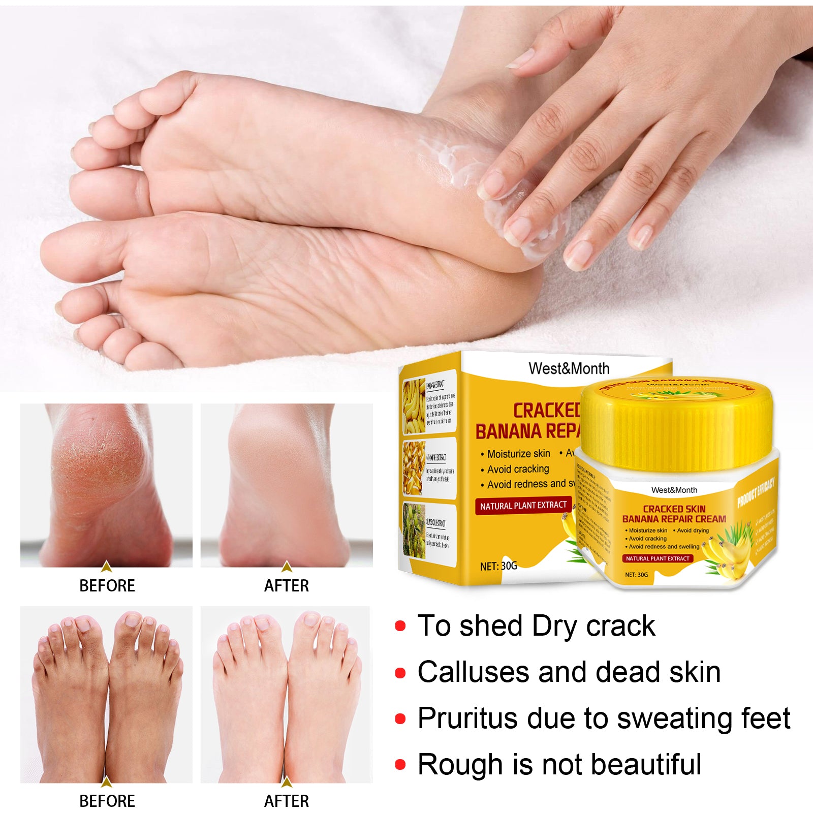 Cracked Skin Banana Repair Cream, Nourishing And Moisturizing Foot Repair Cream To Soften Exfoliation And Remove Dead Skin Calluses Health Eprolo https://www.cyberehub.com
