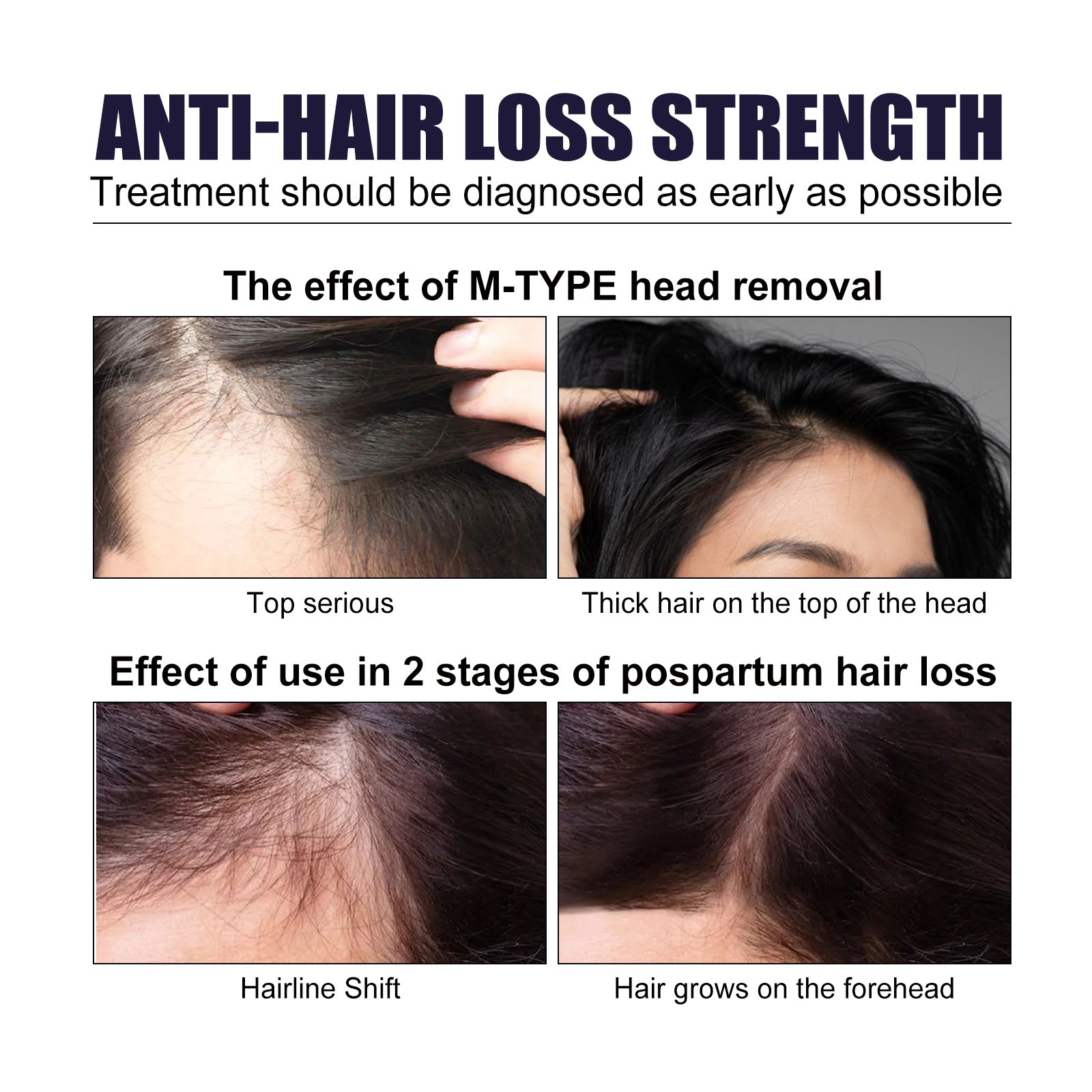 Hair Dense Herbal Spray, Nourishes Hair Prevents Hair Loss Strengthens And Thickens Hair Spray Health Eprolo https://www.cyberehub.com