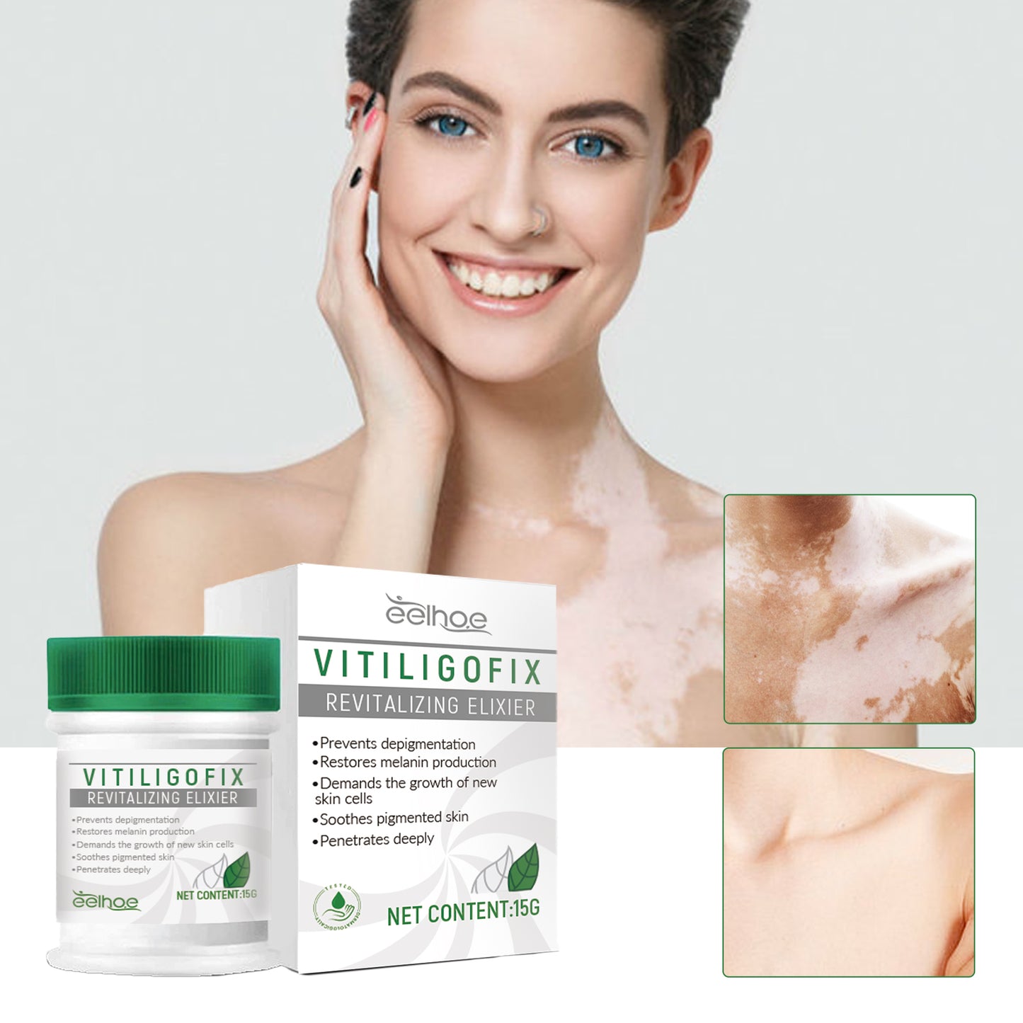 White Spot Repair Cream Skin White Spot Melanin Repair Even Skin Tone Topical Care Cream Health & Beauty Health Eprolo https://www.cyberehub.com