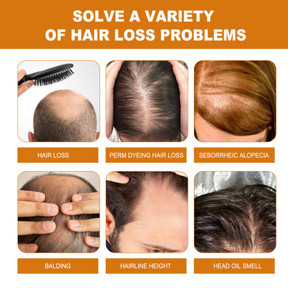 Rice Dense Hair Shampoo Deep Clean Thick Hair Moisturizing Hair Root Solid Hair Care Shampoo Health Eprolo https://www.cyberehub.com