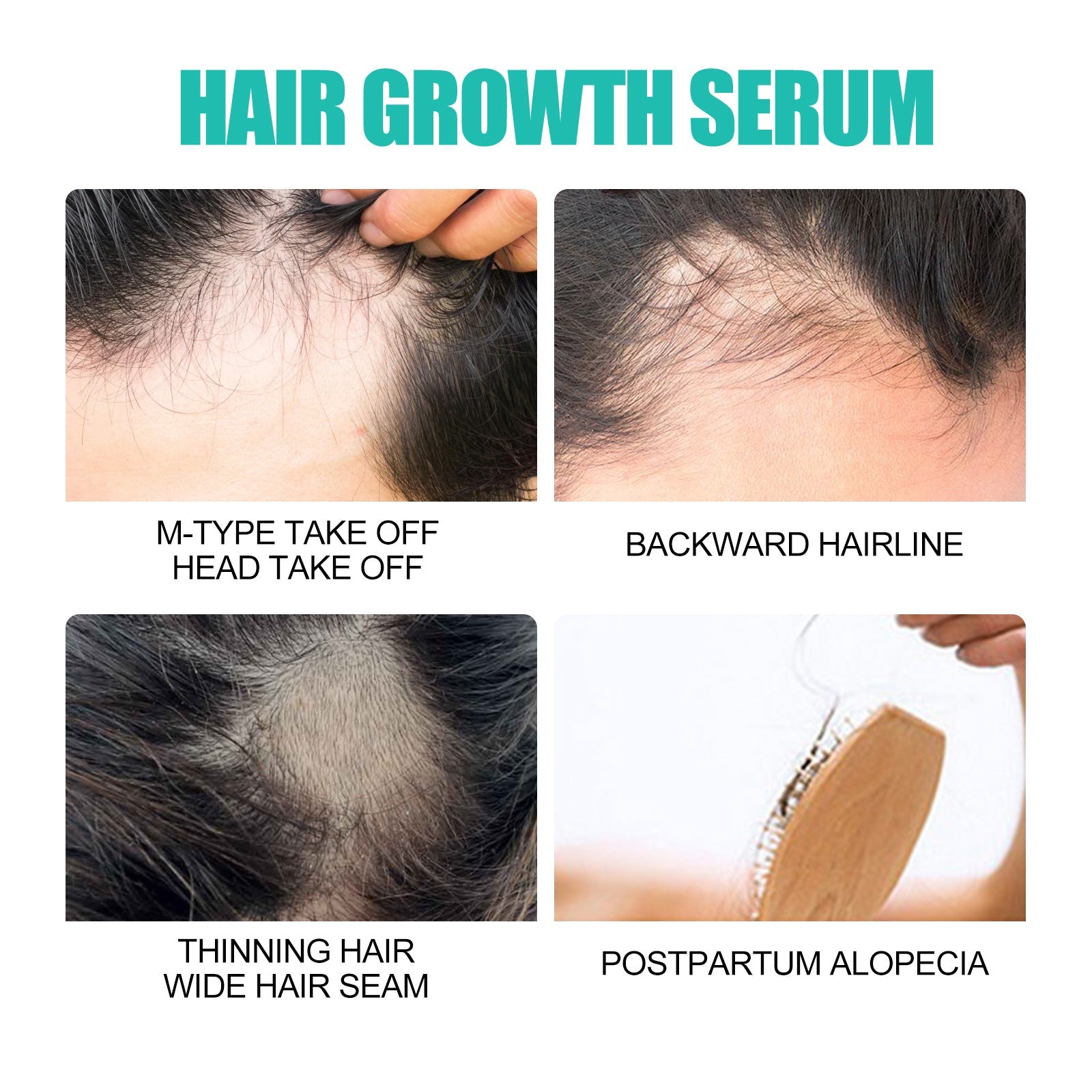 Dry Hairy And Dense Hair Essence Health & Beauty Health & Beauty Under 10 UniversalMaax https://www.cyberehub.com