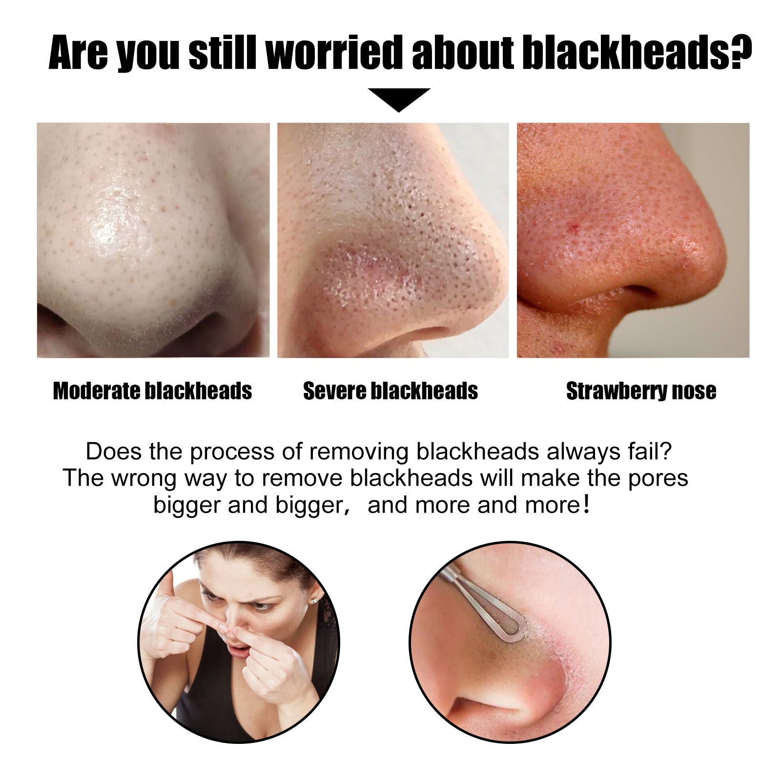 EELHOE Black Pig Nose Patch, Bamboo Charcoal Remove Blackhead Acne Tear Nose Mask Patch Health Eprolo https://www.cyberehub.com