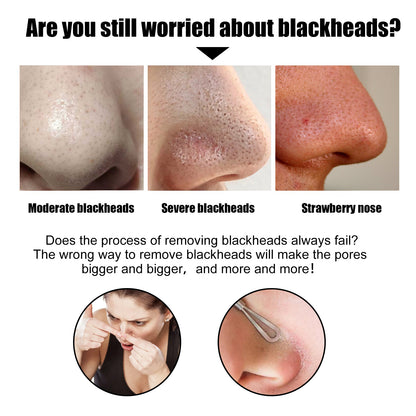 EELHOE Black Pig Nose Patch, Bamboo Charcoal Remove Blackhead Acne Tear Nose Mask Patch Health Eprolo https://www.cyberehub.com