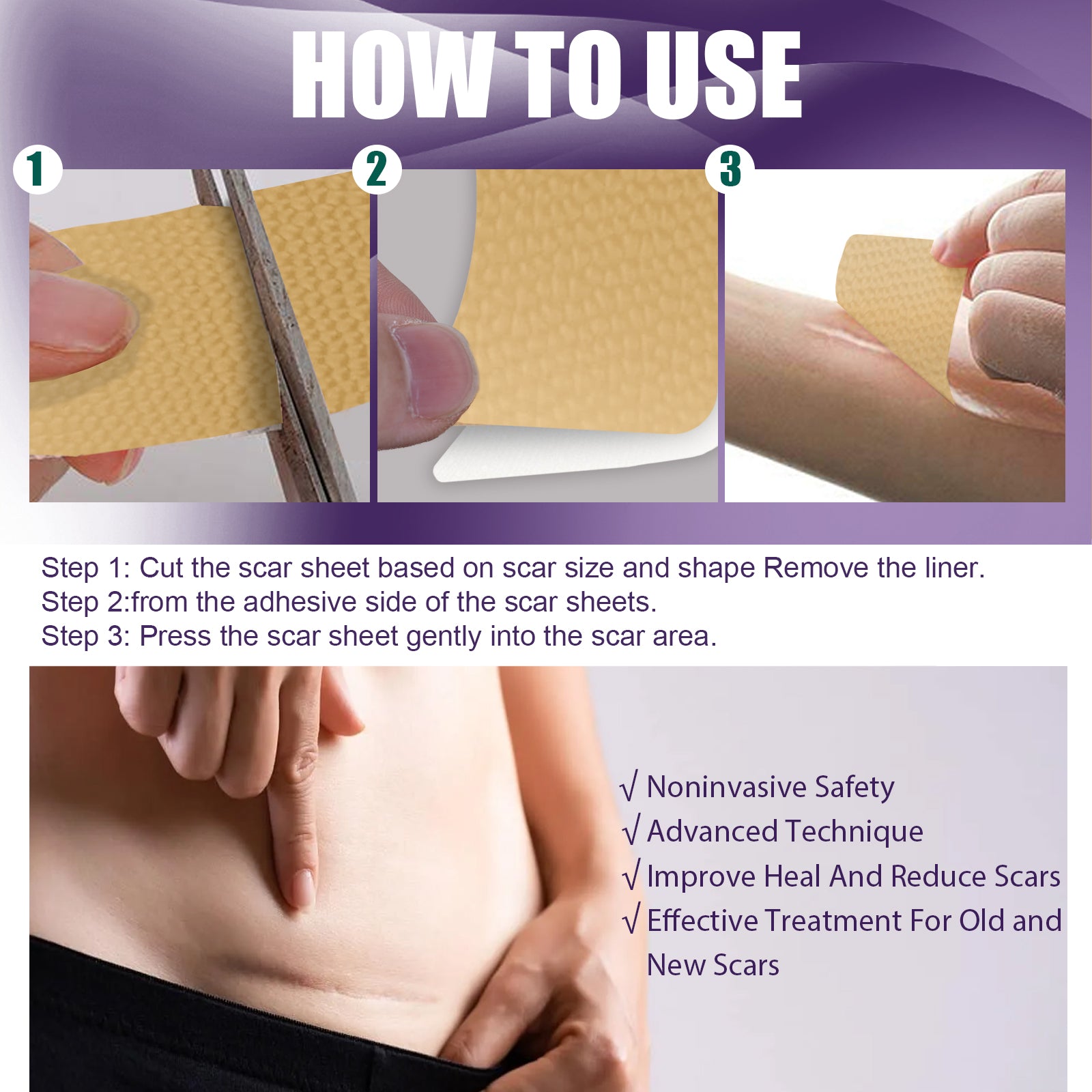 Silicone Scar Patch, Reduces Stretch Marks And Hyperplasia Of Caesarean Section Scars Silicone Patch Health Eprolo https://www.cyberehub.com