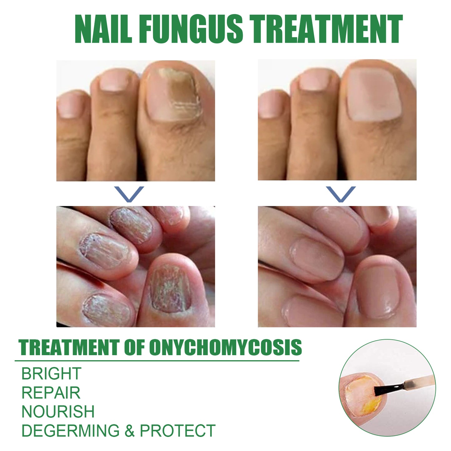 Nail Repair Solution Tea Tree Oil Essence Gentle Nourishing Manicure Cleansing Soft Nail Care Solution Health Eprolo https://www.cyberehub.com