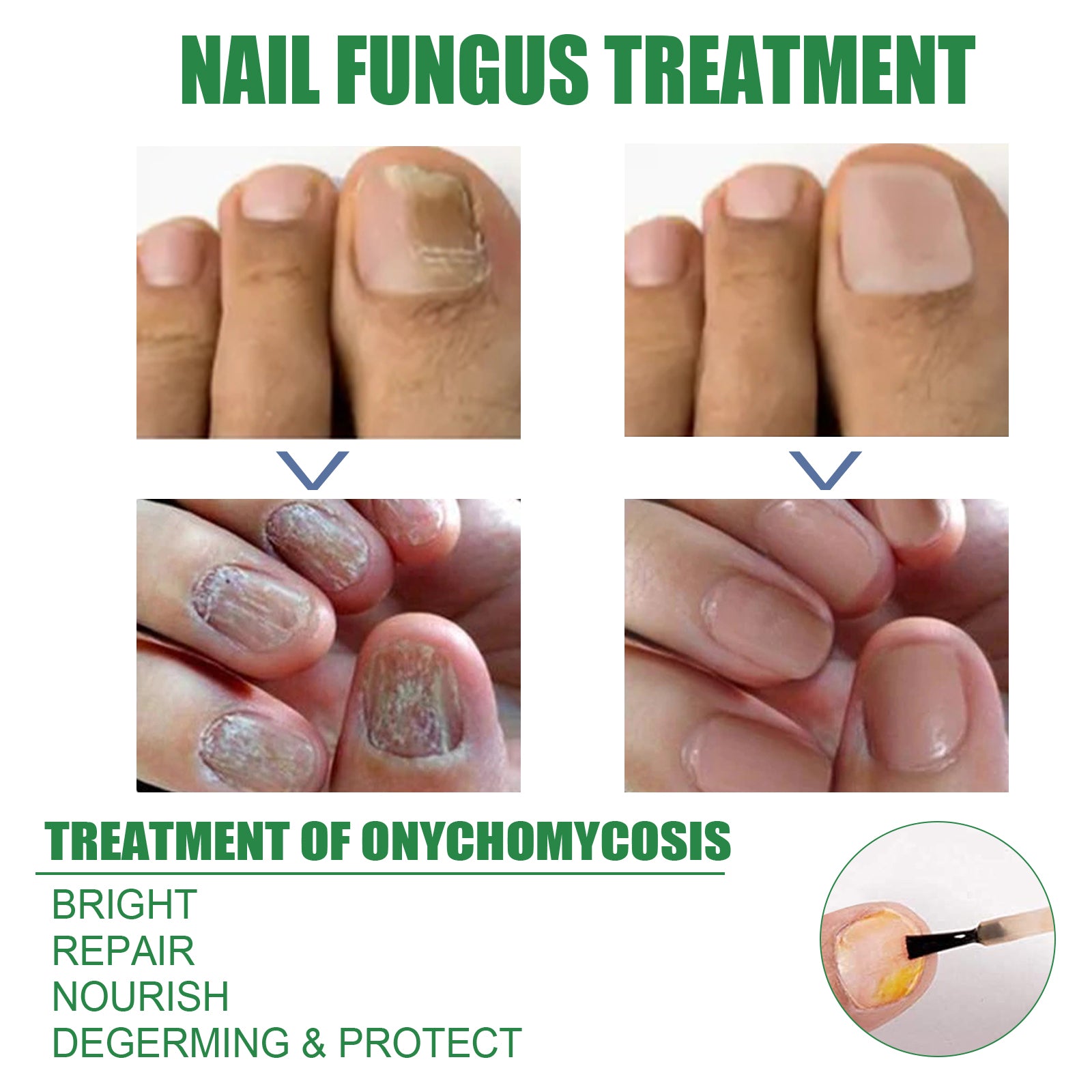 Nail Repair Solution Tea Tree Oil Essence Gentle Nourishing Manicure Cleansing Soft Nail Care Solution Health Eprolo https://www.cyberehub.com