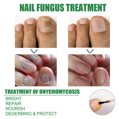 Nail Repair Solution Tea Tree Oil Essence Gentle Nourishing Manicure Cleansing Soft Nail Care Solution Health Eprolo https://www.cyberehub.com