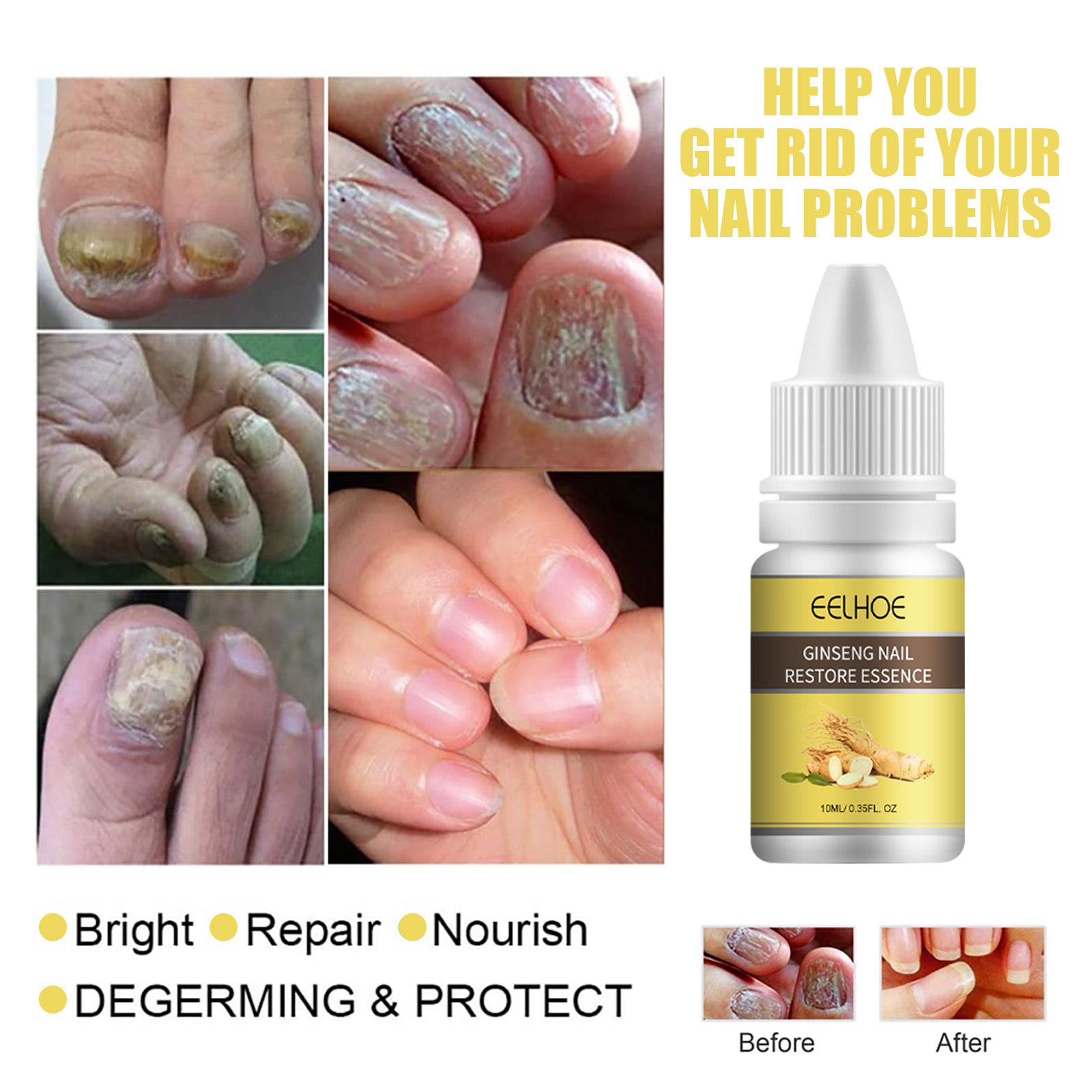 Ginseng Nail Essential Oil Grey Nail Thickening Nail Repair Brightening Nail Removing Soft Nail Moisturizing Essence Health Eprolo https://www.cyberehub.com