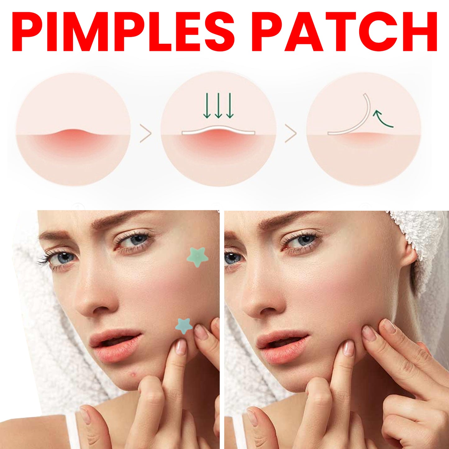 Jaysuing Pimples Patch, Repair Pockmarks Lighten Pimples Blemishes Cover Pimples Health Eprolo https://www.cyberehub.com
