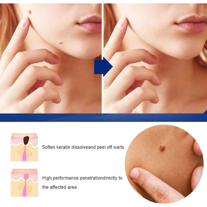 EELHOE Skin Label Repair Cream Relief Mild Ingredient Skin Care Cleanses Body Skin For Extra Care Health Eprolo https://www.cyberehub.com