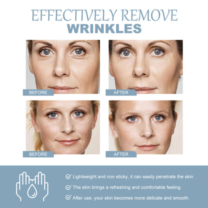WIYUN Hyaluronic Acid Firming Face Cream For Reducing Fine Lines, Anti-Wrinkle Moisturizing And Firming Skin Care Cream Health Eprolo https://www.cyberehub.com