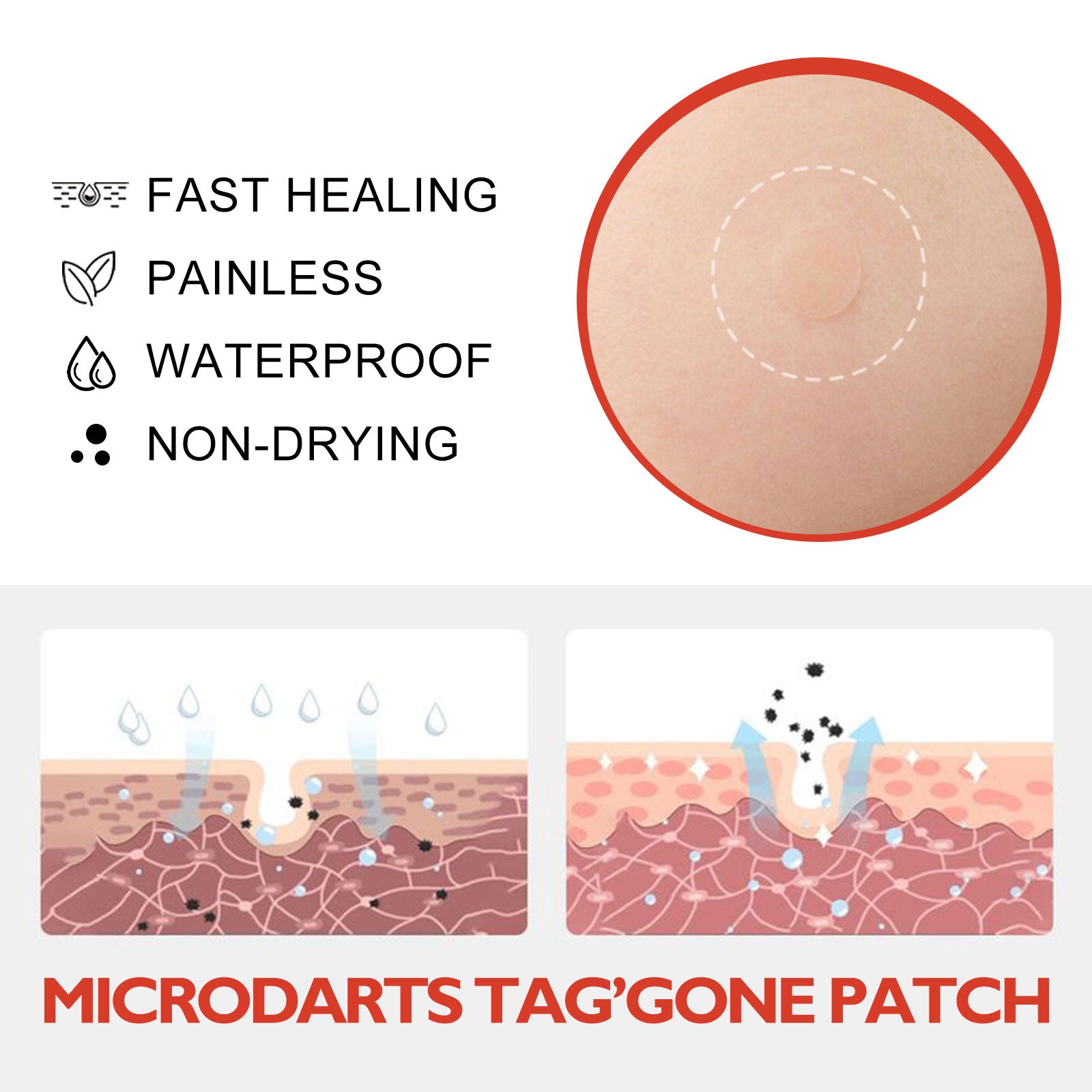 Acne Patch, Skin Clean Acne Pimple Moles Gram Wart Corns Spot Patch Health Eprolo https://www.cyberehub.com