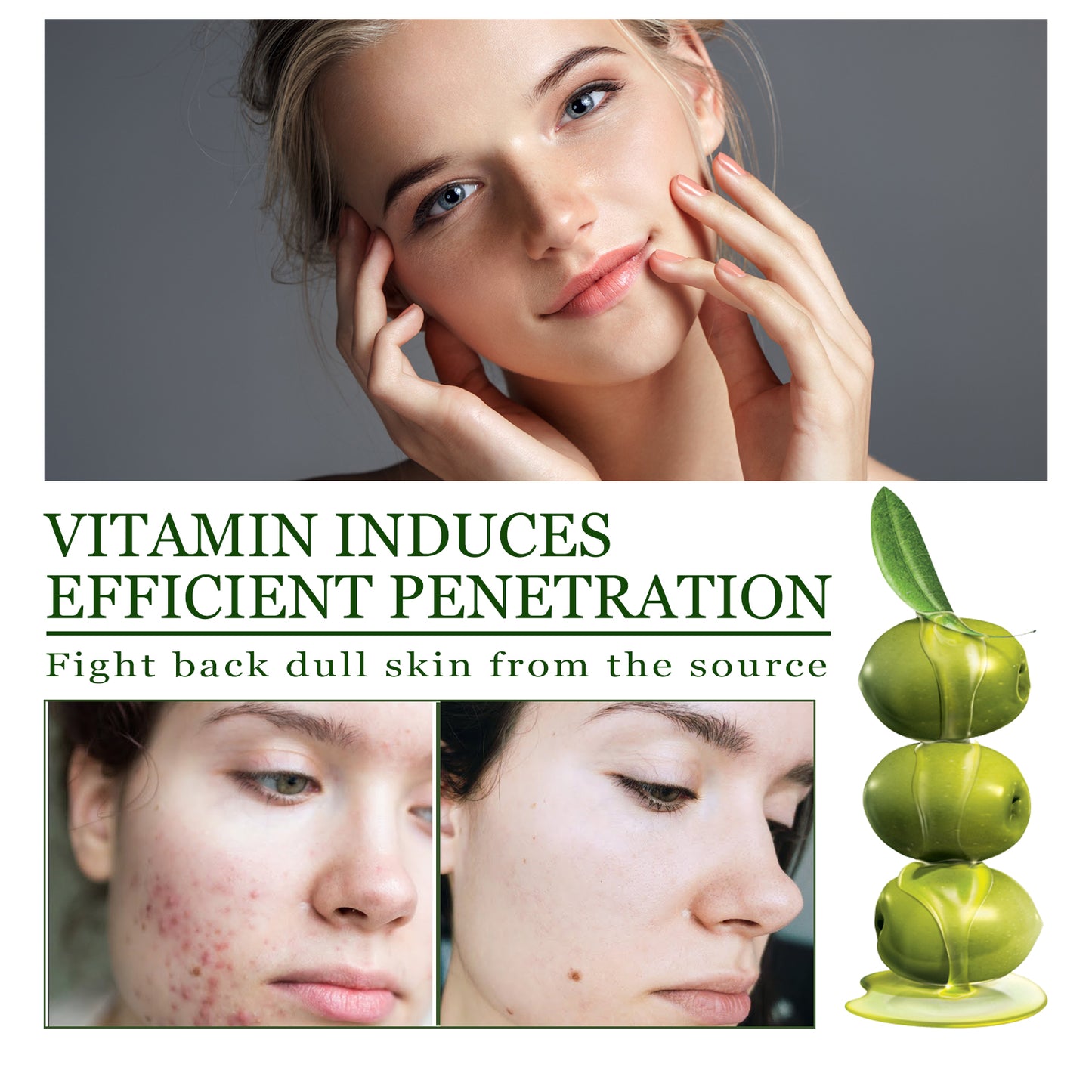 Olive Acne-Clearing Essence, Lightening Acne Mark Removing Closed Mouth Acne Dark Skin Repair Essence Health Eprolo https://www.cyberehub.com