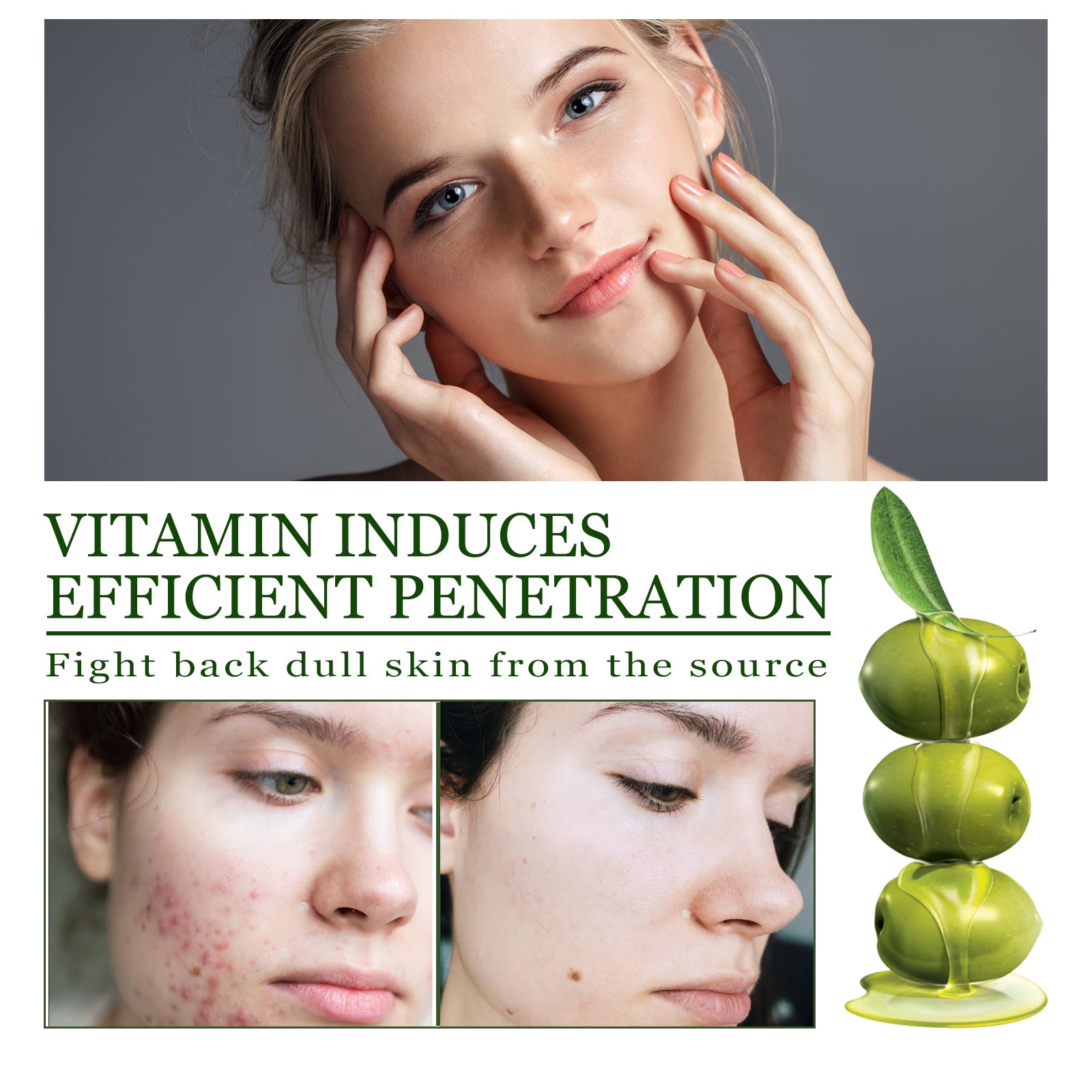 Olive Acne-Clearing Essence, Lightening Acne Mark Removing Closed Mouth Acne Dark Skin Repair Essence Health Eprolo https://www.cyberehub.com
