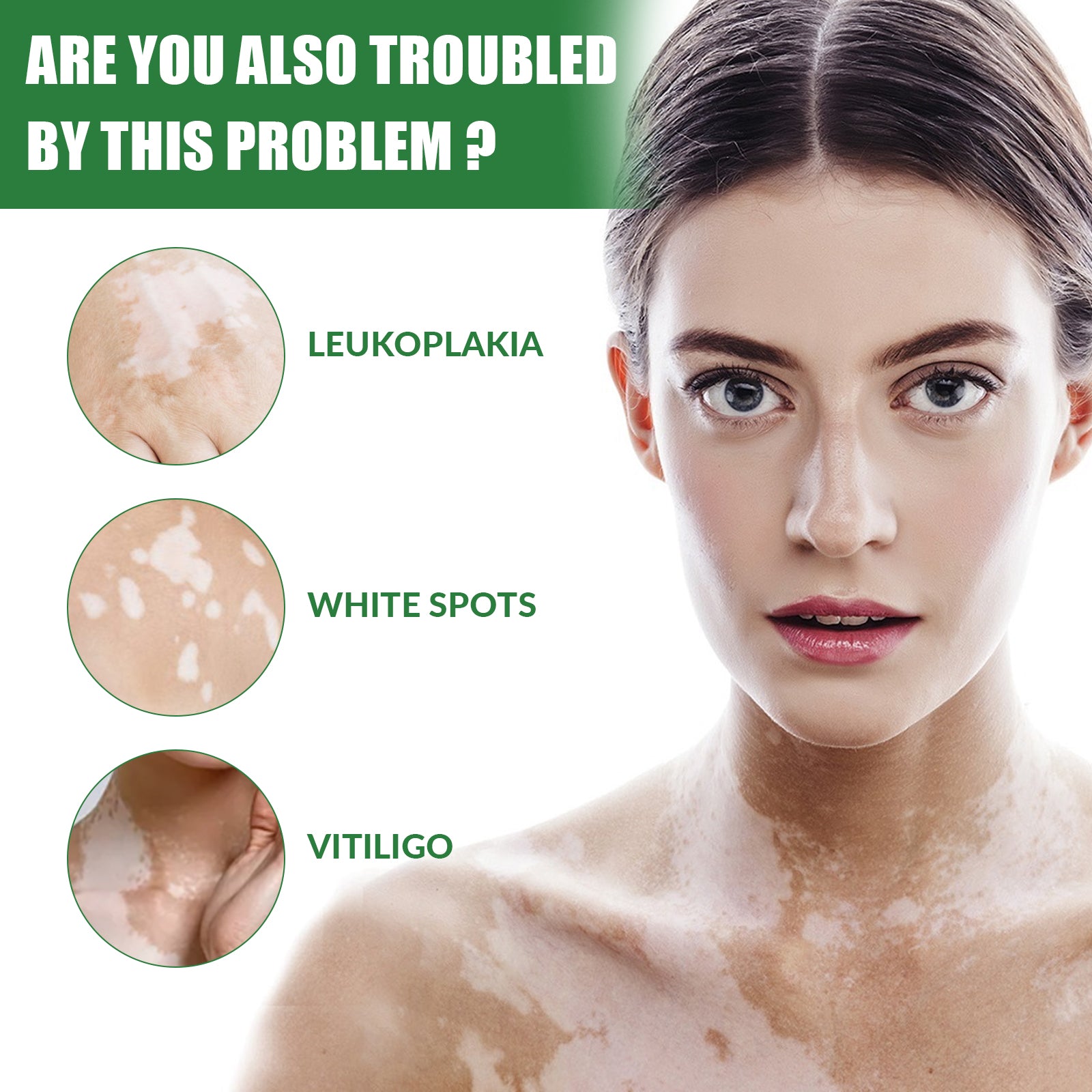 White Spot Repair Cream Skin White Spot Melanin Repair Even Skin Tone Topical Care Cream Health & Beauty Health Eprolo https://www.cyberehub.com