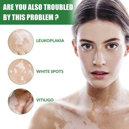 White Spot Repair Cream Skin White Spot Melanin Repair Even Skin Tone Topical Care Cream Health & Beauty Health Eprolo https://www.cyberehub.com