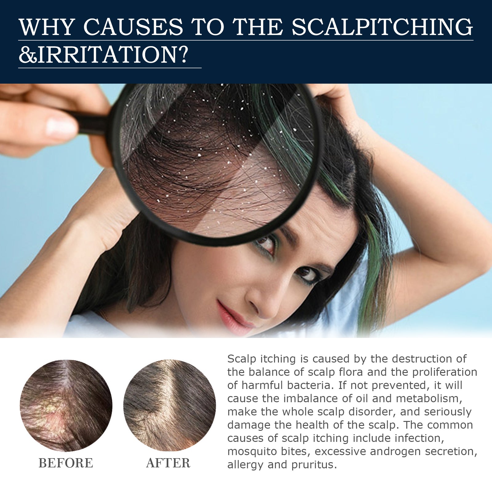 Scalp Treatment Essence Spray, Hair Care And Repair Damaged Hair Follicle Hair Root Treatment Spray Health Eprolo https://www.cyberehub.com