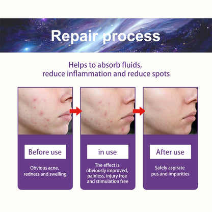 Breathable Repair Acne Skin Pattern Acne Patch Health & Beauty Health & Beauty Under 10 UniversalMaax https://www.cyberehub.com