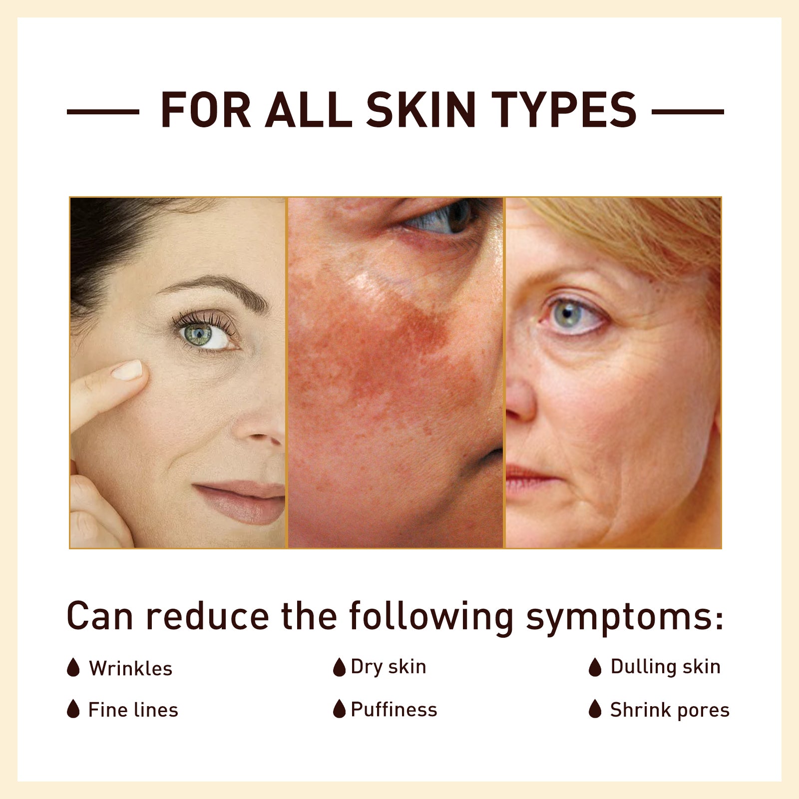 Rice Anti Wrinkle Essence, Repairs Skin Moisturizes Firms Whitens Essence Health Eprolo https://www.cyberehub.com