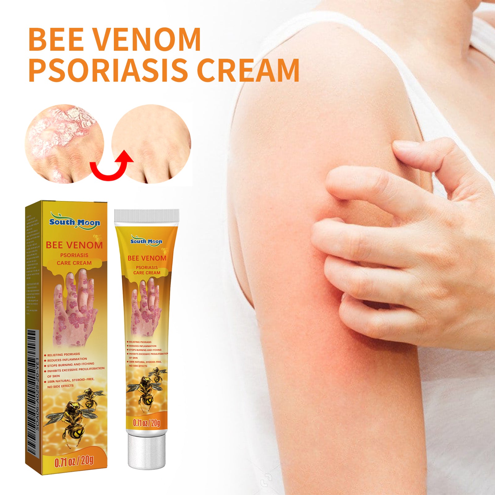 Bee Venom Psoriasis Cream, Relieve Itchy Skin Repair Hand Moss Moisturizing Skin Care Cream Health Eprolo https://www.cyberehub.com