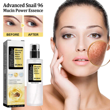 Snail 96 Collagen Power Essence, Repair Skin Barrier Moisturizing And Fading Dark Spots Snail Essence Health Eprolo https://www.cyberehub.com