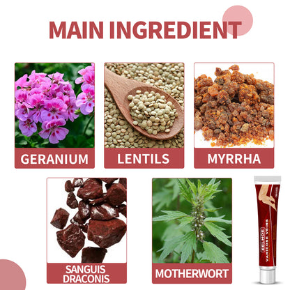 Venous Massage Varicose Cream, Relieves Bulging Leg Blood Vessels And Swollen Leg Earthworm Venous Massage Cream Health Eprolo https://www.cyberehub.com