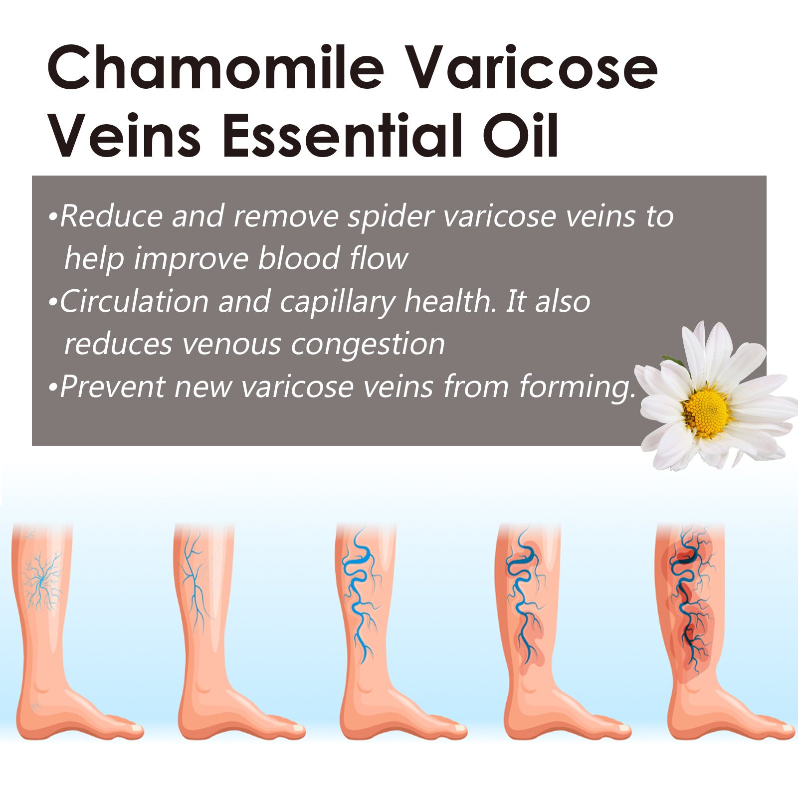 Chamomile Leg Essential Oil Protects Leg Skin And Relieves Leg Discomfort With Daily Massage Essential Oil Health Eprolo https://www.cyberehub.com