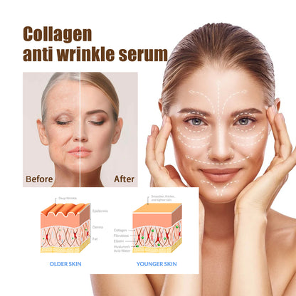 Collagen Anti-Aging Essence, Hydrating, Firming And Smoothing Lines Delicate Facial Skin Essence Health Eprolo https://www.cyberehub.com