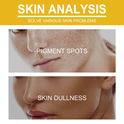 V7 Whitening Cream Reduces Wrinkles And Fine Lines On The Face, Moisturizes And Brightens Skin, Anti-Aging And Replenishing Cream Health Eprolo https://www.cyberehub.com
