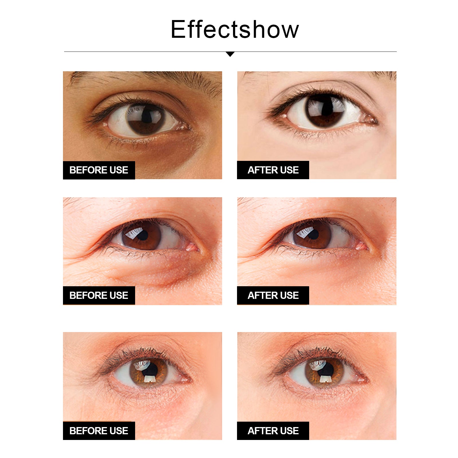 Snake Venom Eye Cream, Firming Eye Bags Hydrating And Reducing Fine Lines Eye Care Eye Cream Health Eprolo https://www.cyberehub.com
