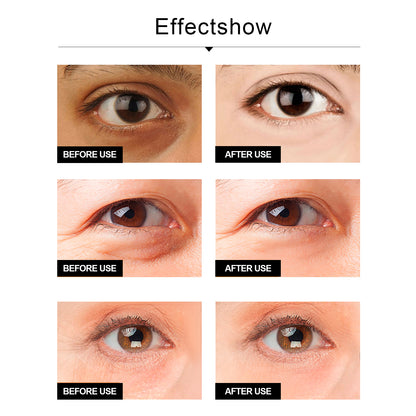 Snake Venom Eye Cream, Firming Eye Bags Hydrating And Reducing Fine Lines Eye Care Eye Cream Health Eprolo https://www.cyberehub.com