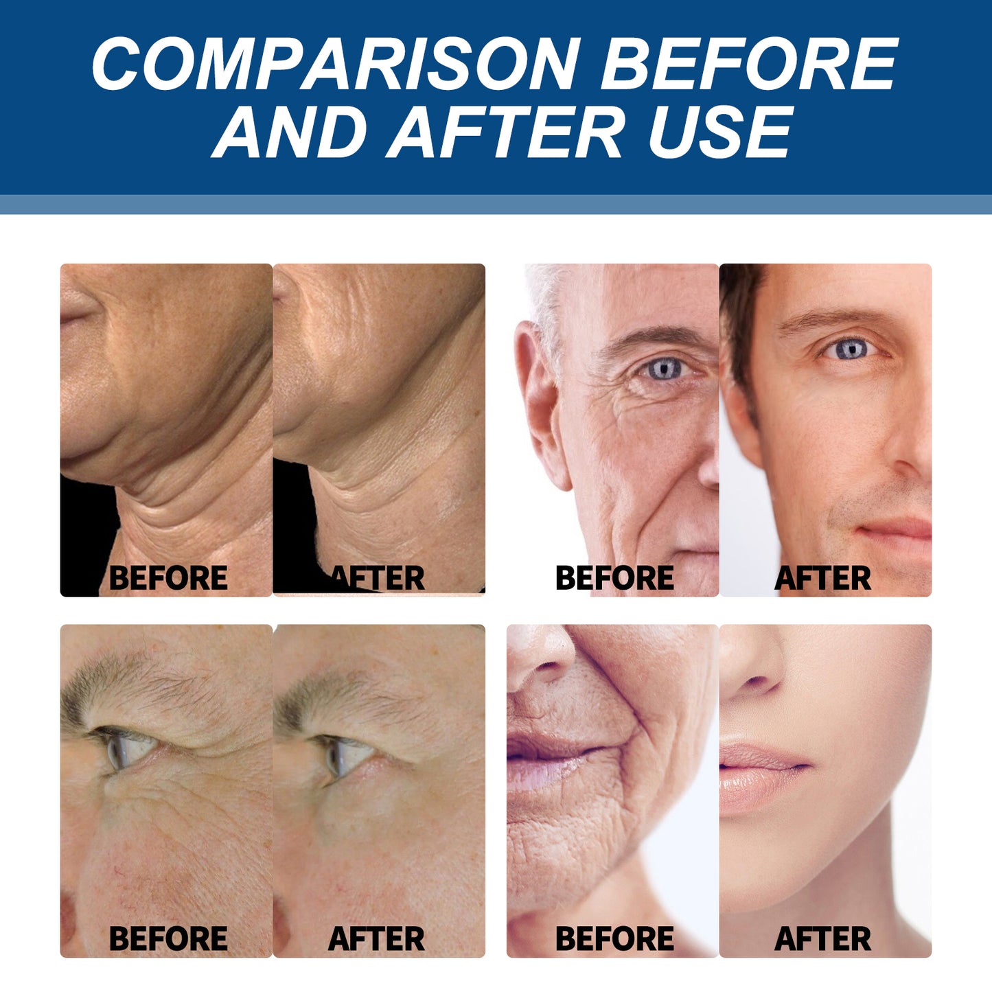 Collagen Wrinkle Remover Cream for Men, Anti Aging Fade Fine Lines Tightening Hydrating Cream Health Eprolo https://www.cyberehub.com