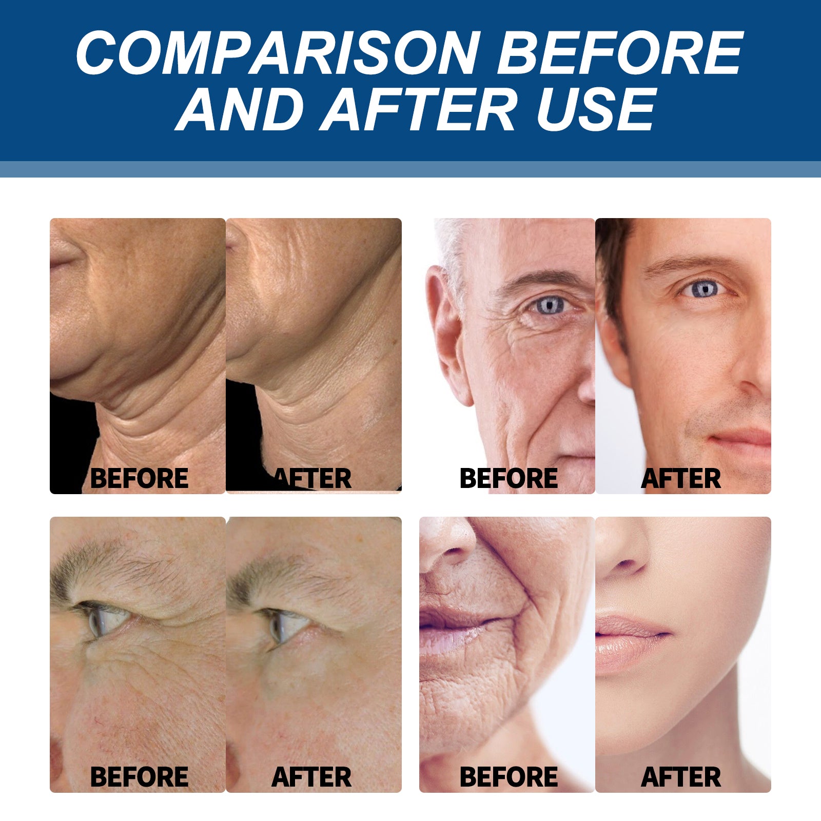 Collagen Wrinkle Remover Cream for Men, Anti Aging Fade Fine Lines Tightening Hydrating Cream Health Eprolo https://www.cyberehub.com