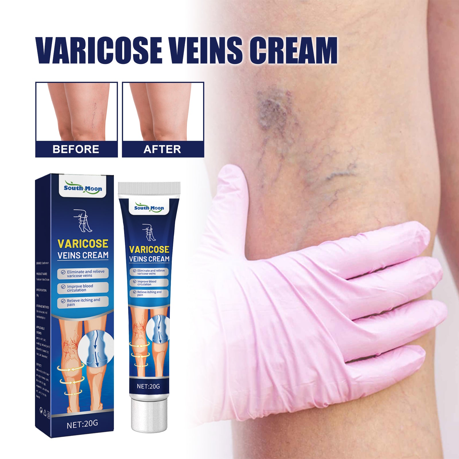 Vein Massage Varicose Cream Repair Earthworm Legs To Relieve Leg Blood Vessel Bulge And Varicoidea Health Eprolo https://www.cyberehub.com
