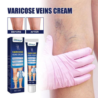 Vein Massage Varicose Cream Repair Earthworm Legs To Relieve Leg Blood Vessel Bulge And Varicoidea Health Eprolo https://www.cyberehub.com