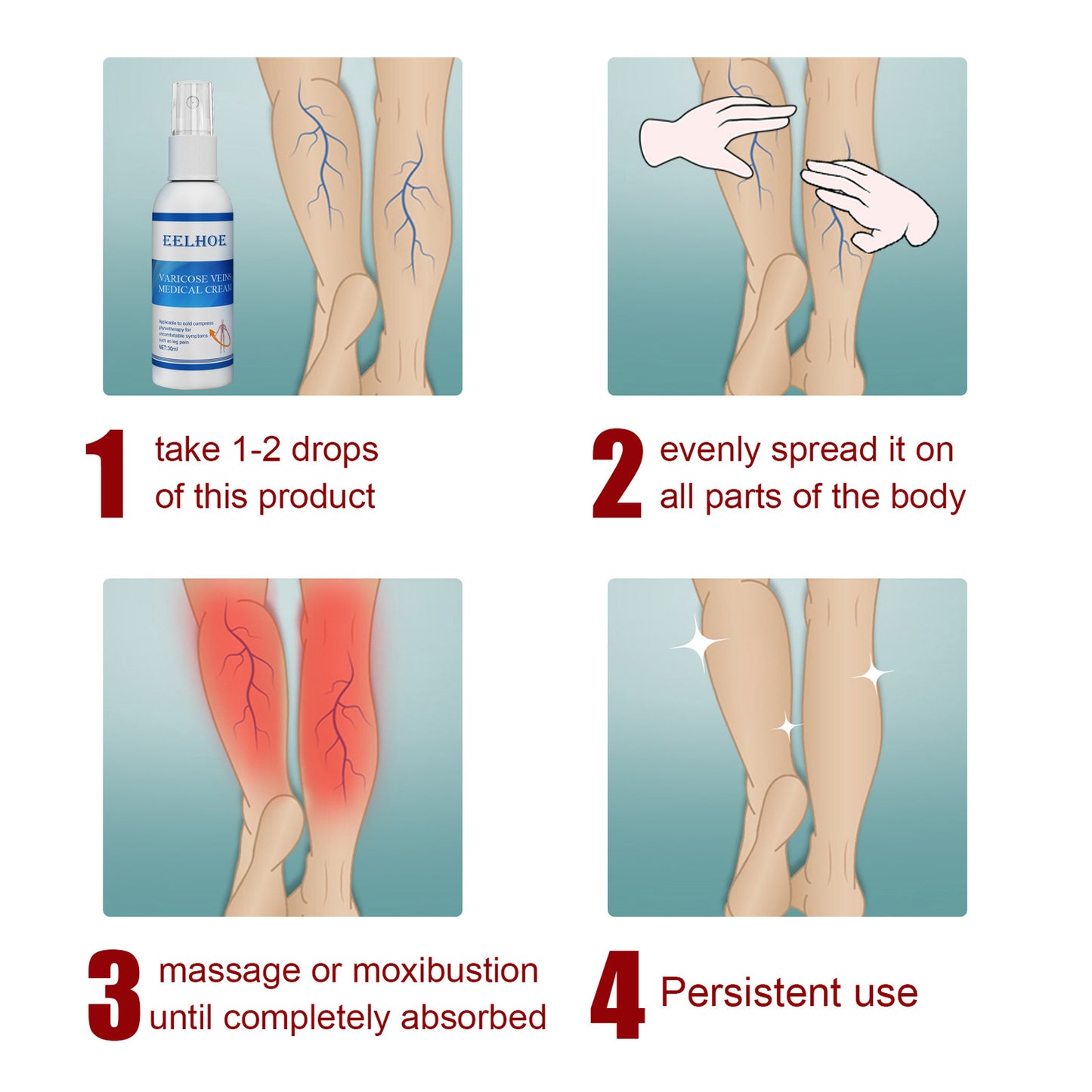 Intravenous Massage Spray For Varicose Veins Relief And Earthworm Leg Blood Vessel Bulge Pain Spray Health Eprolo https://www.cyberehub.com