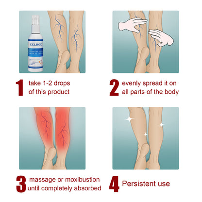 Intravenous Massage Spray For Varicose Veins Relief And Earthworm Leg Blood Vessel Bulge Pain Spray Health Eprolo https://www.cyberehub.com