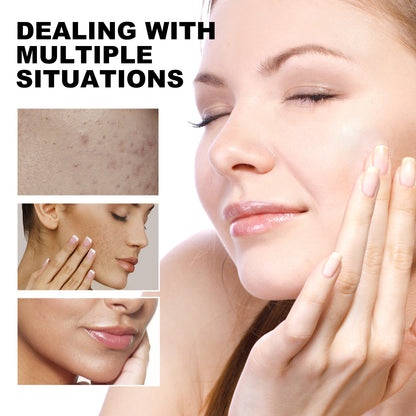EelHope Turmeric & Kojic Cleansing Pads, Deep Clean Delicate Pores Reduce Acne Spots Facial Skin Brightening Health Eprolo https://www.cyberehub.com
