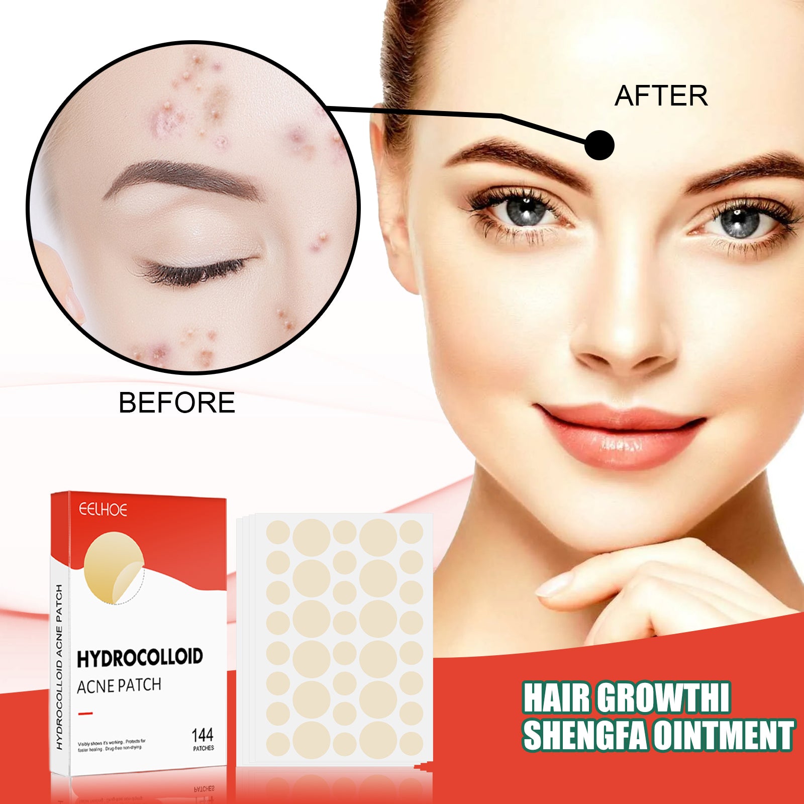Hydrocolloid Acne Patch Face Invisible Makeup Closed Mouth Acne Clear Acne Waterproof Breathable Facial Treatment Health Eprolo https://www.cyberehub.com